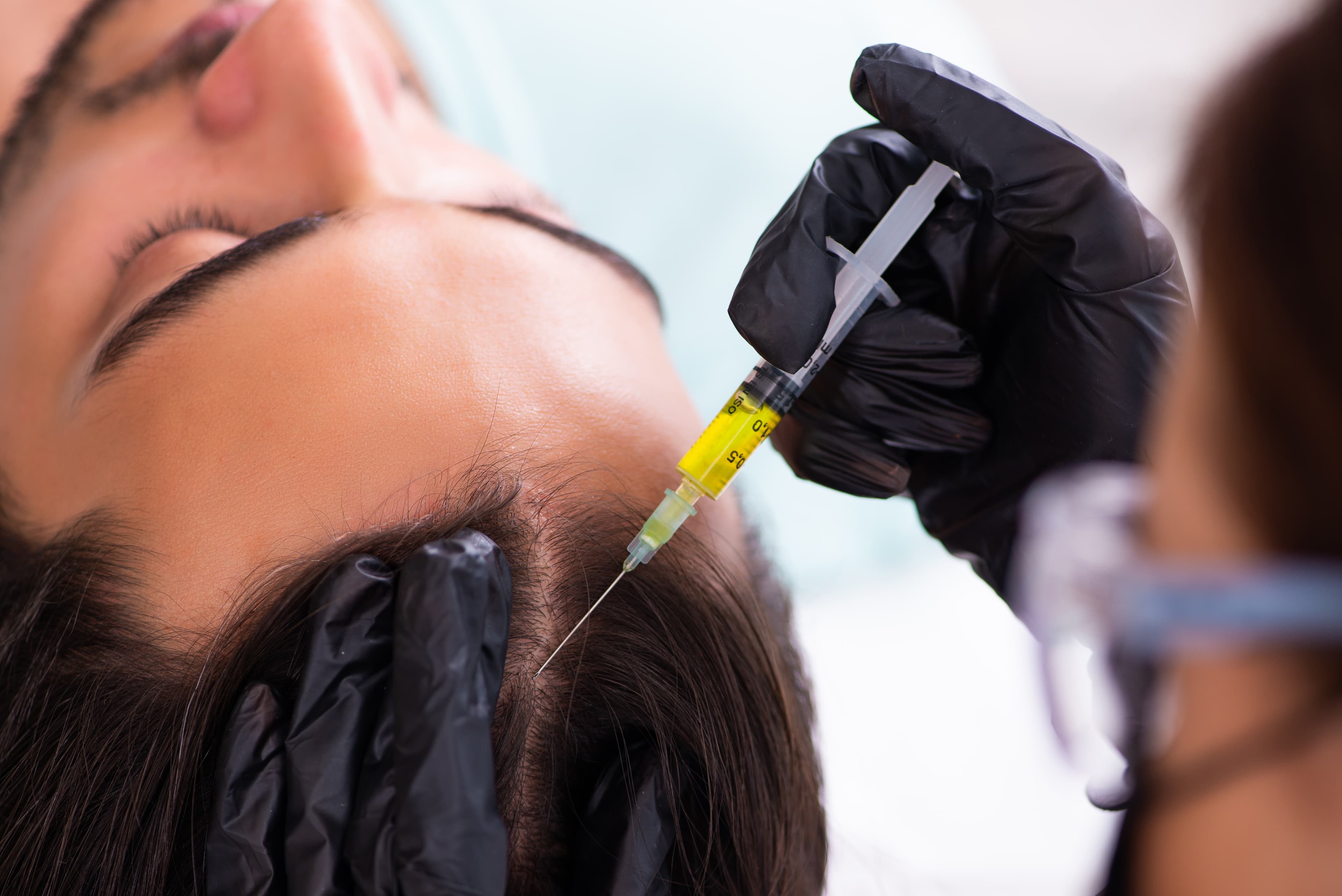 Hair Loss Treatment